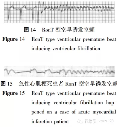 心電圖危急值識別