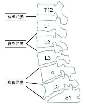 传统观念认为,cage植入后可以有效撑开并恢复正常椎间高度,以扩大椎间